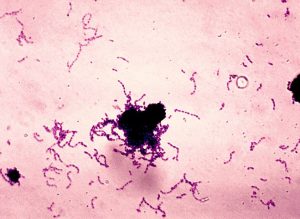 streptococcus_mutans_01
